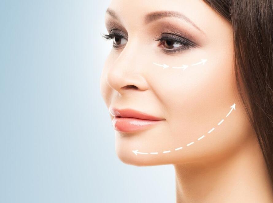 Fransız İp Askı ile Uzun Süreli Yüz Liftingi