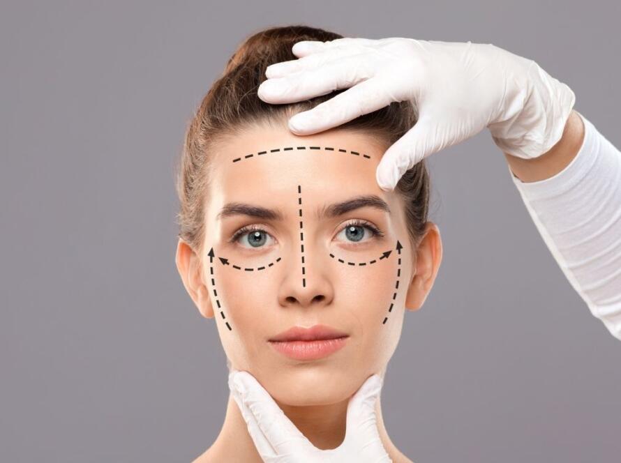 Fransız İp Askılama ile Hızlı ve Doğal Yüz Gençleştirme