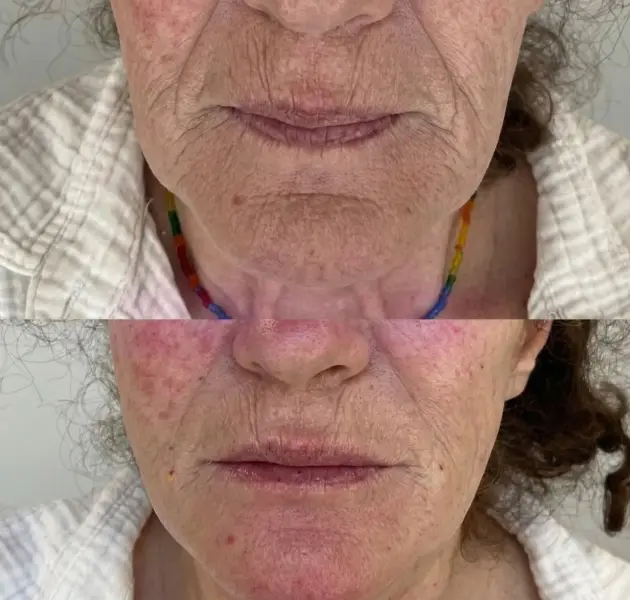 otolog-kok-hucre-006